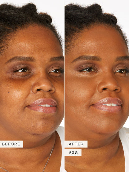 Base Alta Cobertura- Medikal Care